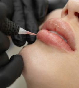 cosmetic-lips